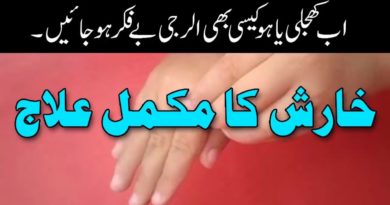 Kharish Ka Fori ilaj-Itching Desi Treatment-How To Stop Skin Itching