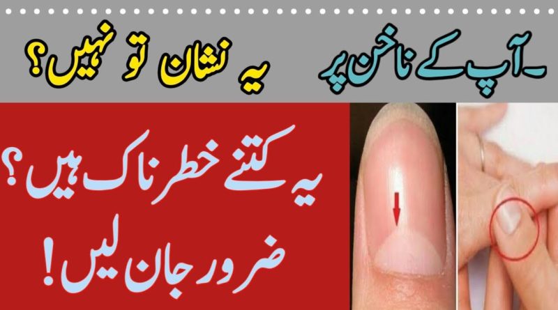 Nails Par Sufaid Nishan Ka Matlab-What Causes White Marks On Nails