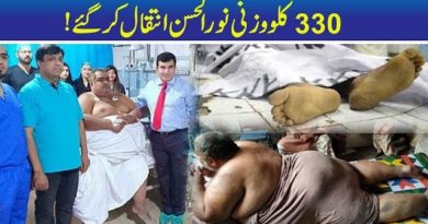330 Kg Heavy Man Noor-ul-Hassan Passes Away-Geo urdu News